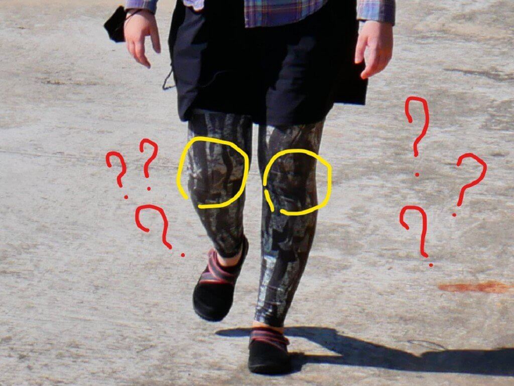 knees in knaypyitaw